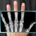 Рентгенова снимка на вашия мобилен телефон – Вижте как да изтеглите приложението
