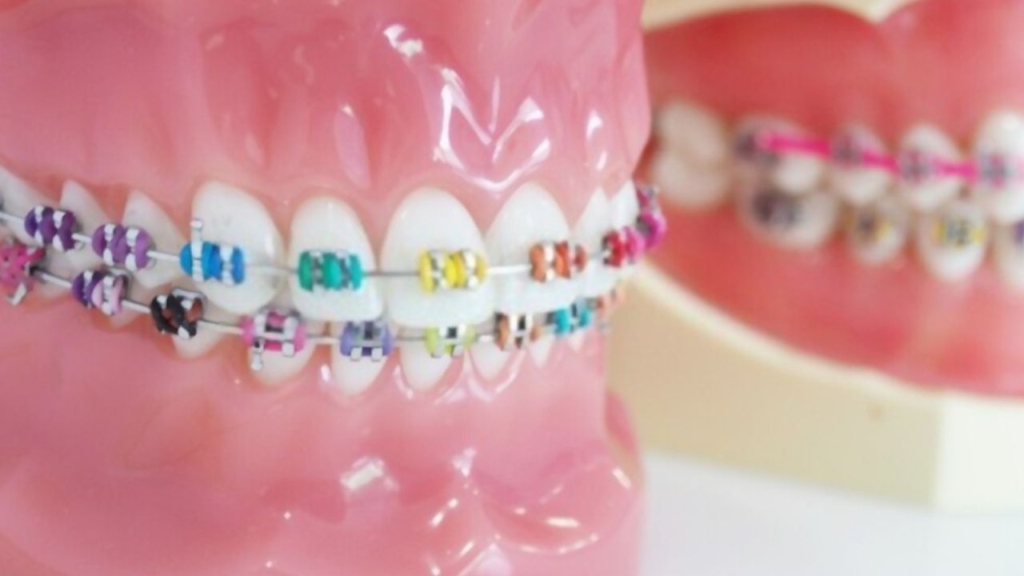 programu ya orthodontic appliance