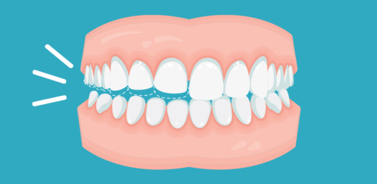 Desencostar os dentes – Aplicativo que contribui com a saúde bucal
